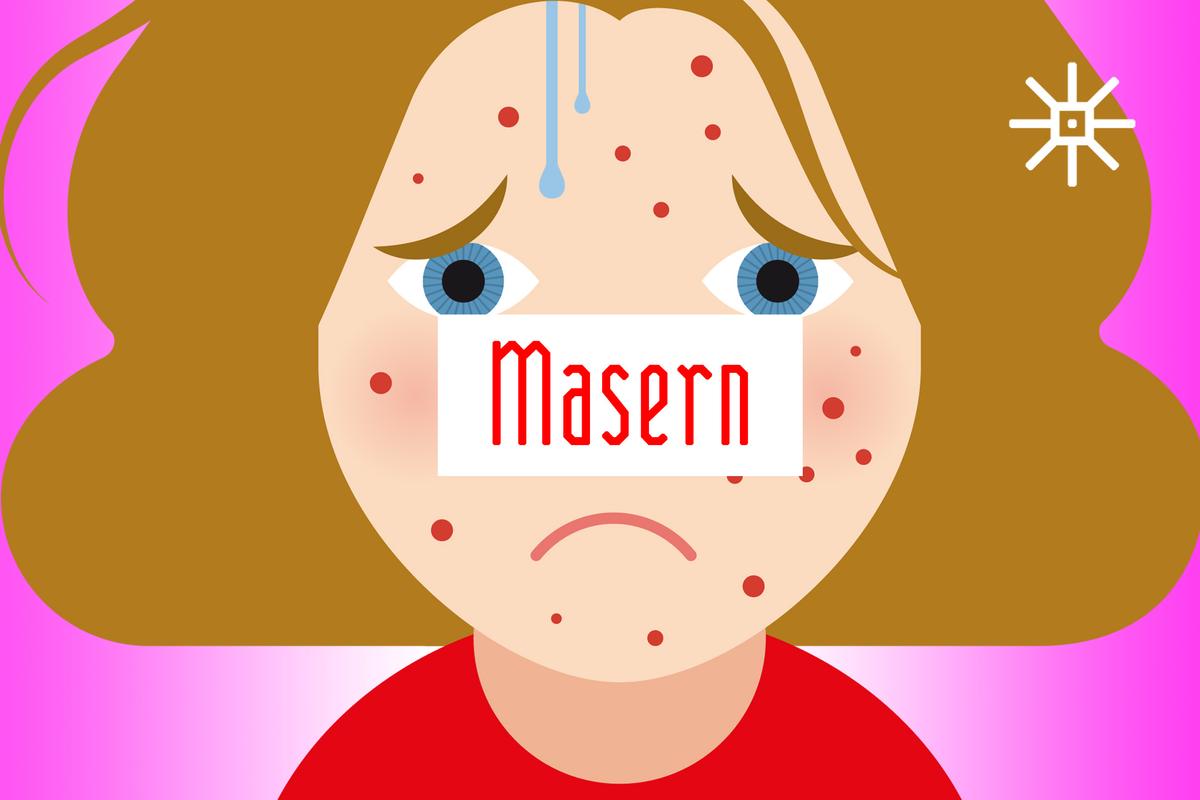 Illustration eines Kindes mit Masern-Ausschlag im Gesicht von Rike Hofmann